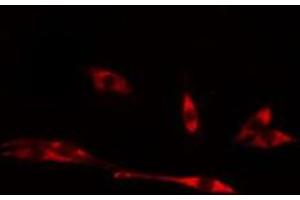 ABIN6275011 staining LOVO cells by IF/ICC. (CHPF Antikörper  (C-Term))