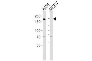 Western blot analysis of lysate from A431, MCF-7 cell line (left to right) using EGF Receptor antibody at 1:1000 for each lane. (EGFR Antikörper  (AA 1163-1191))