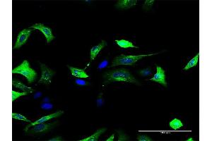 Immunofluorescence of purified MaxPab antibody to FOLR1 on HeLa cell.