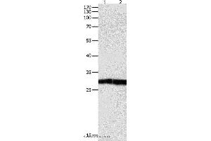 Western blot analysis of Jurkat cell and human fetal kidney tissue, using DUSP6 Polyclonal Antibody at dilution of 1:450 (DUSP6 Antikörper)