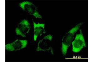 Immunofluorescence of purified MaxPab antibody to USP10 on HeLa cell.