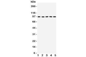 Western blot testing of TRKC antibody on Lane 1: rat brain;  2: mouse brain;  3: human U87;  4: (h) SHG-44;  5: (m) Neuro-2a cell lysate.