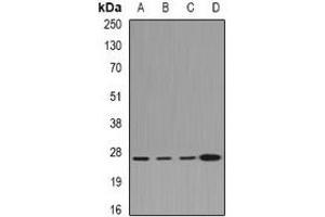 Western blot analysis of CLIC1 expression in Hela (A), HepG2 (B), mouse lung (C), rat kidney (D) whole cell lysates. (CLIC1 Antikörper)