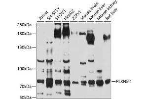 Western blot analysis of extracts of various cell lines, using PLXNB2 antibody (ABIN6129079, ABIN6145808, ABIN6145809 and ABIN6214190) at 1:1000 dilution. (Plexin B2 Antikörper  (AA 1080-1200))