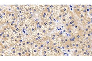Detection of BAD in Human Adrenal gland Tissue using Polyclonal Antibody to Bcl2 Associated Death Promoter (BAD)