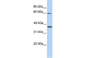 Human Liver; WB Suggested Anti-ZNF677 Antibody Titration: 0. (ZNF677 Antikörper  (C-Term))
