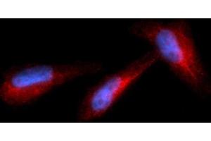 Immunofluorescence (IF) image for anti-Granzyme B (GZMB) (AA 21-247) antibody (PE) (ABIN5564764) (GZMB Antikörper  (AA 21-247) (PE))
