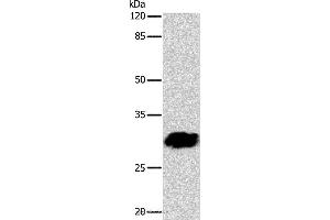 Western blot analysis of 293T cell, using GJB6 Polyclonal Antibody at dilution of 1:1040