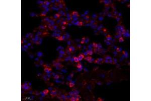 Immunofluorescence of paraffin embedded mouse lung using ARHGAP18 (ABIN7075417) at dilution of 1: 700 (450x lens) (ARHGAP18 Antikörper)