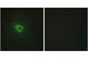Immunofluorescence analysis of HeLa cells, using JAK1 Antibody. (JAK1 Antikörper  (AA 91-140))