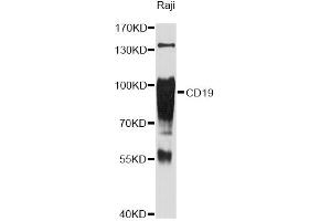 Western blot analysis of extracts of Raji cells, using CD19 Antibody (ABIN5971402) at 1:3000 dilution. (CD19 Antikörper)