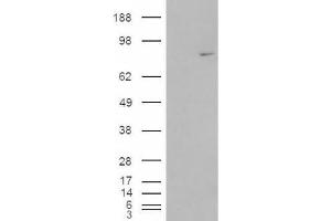Western Blotting (WB) image for anti-Methylphosphate Capping Enzyme (MEPCE) (Internal Region) antibody (ABIN2465942) (MEPCE Antikörper  (Internal Region))