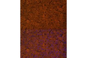 Immunofluorescence (IF) image for anti-UDP Glucuronosyltransferase 1 Family, Polypeptide A1 (UGT1A1) (AA 1-200) antibody (ABIN6149895)
