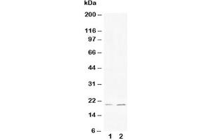 Western blot testing of Bcl-XS antibody and Lane 1:  HeLa (Bcl-X/s (AA 120-130) Antikörper)