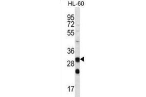 Western Blotting (WB) image for anti-Carbonic Anhydrase VI (CA6) antibody (ABIN2996883) (CA6 Antikörper)