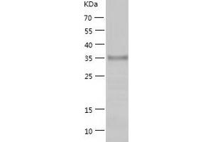 Western Blotting (WB) image for Receptor Tyrosine Kinase-Like Orphan Receptor 1 (ROR1) (AA 30-406) protein (His tag) (ABIN7124800) (ROR1 Protein (AA 30-406) (His tag))