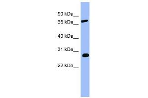 COMT antibody used at 1 ug/ml to detect target protein.