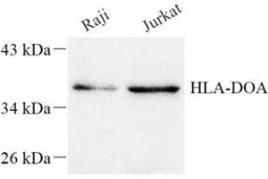 Western blot analysis of HLADOA (ABIN7074244) at dilution of 1: 1500 (HLA-DOA Antikörper)