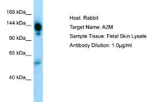 Host: RabbitTarget Name: A2MAntibody Dilution: 1. (alpha 2 Macroglobulin Antikörper  (N-Term))