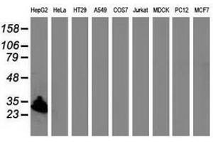 Image no. 1 for anti-Sulfotransferase Family, Cytosolic, 1A, Phenol-Preferring, Member 1 (SULT1A1) antibody (ABIN1501227) (SULT1A1 Antikörper)
