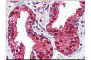 Immunohistochemistry (IHC) image for anti-Folate Hydrolase (Prostate-Specific Membrane Antigen) 1 (FOLH1) (AA 117-351) antibody (ABIN317554) (PSMA Antikörper  (AA 117-351))