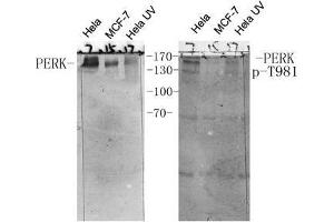 Western Blot (WB) analysis of specific cells using antibody diluted at 1:1000. (PERK Antikörper  (pThr981))