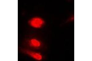 Immunofluorescent analysis of Annexin A11 staining in Jurkat cells. (Annexin A11 Antikörper)