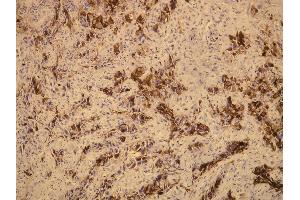 Immunohistochemistry (IHC) image for anti-Mucin 1 (MUC1) (C-Term) antibody (ABIN870418) (MUC1 Antikörper  (C-Term))