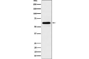 Western blot analysis of HRPT2/CDC73 expression in 293T cell lysate. (Rekombinanter HRPT2 Antikörper)
