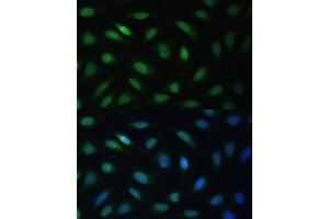 Immunofluorescence analysis of U-2 OS cells using LBR Polyclonal Antibody (ABIN6128194, ABIN6143105, ABIN6143106 and ABIN6221130) at dilution of 1:100 (40x lens).