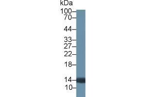 Detection of PTK6 in Rat Prostate lysate using Polyclonal Antibody to Protein Tyrosine Kinase 6 (PTK6) (PTK6 Antikörper  (AA 191-445))