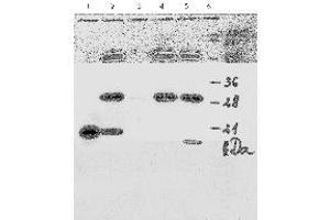 Western Blotting (WB) image for anti-Human Papilloma Virus 18 E7 (HPV-18 E7) (AA 1-35), (N-Term) antibody (ABIN781779) (HPV18 E7 Antikörper  (N-Term))