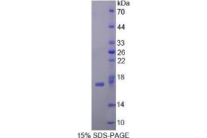 Image no. 1 for Cytidine Deaminase (CDA) (AA 2-146) protein (His tag) (ABIN6237786) (CDA Protein (AA 2-146) (His tag))