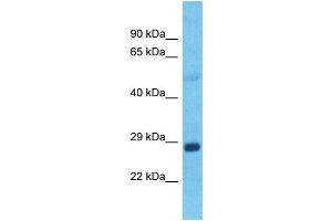 Host:  Rabbit  Target Name:  GRHL1  Sample Type:  Lung tumor lysates  Antibody Dilution:  1. (GRHL1 Antikörper  (C-Term))