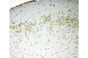 Anti-VE Cadherin antibody, IHC(P) IHC(P): Rat Brain Tissue