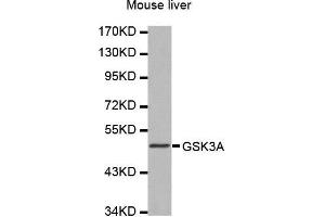 Western Blotting (WB) image for anti-Glycogen Synthase Kinase 3 alpha (GSK3a) (AA 409-483) antibody (ABIN1680131) (GSK3 alpha Antikörper  (AA 409-483))
