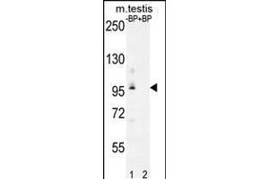 Western blot analysis of PDPR Antibody Pab pre-incubated without(lane 1) and with(lane 2) blocking peptide in mouse testis tissue lysate (PDP Antikörper  (C-Term))