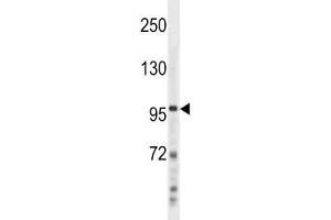 NFKB2 antibody western blot analysis in NCI-H460 lysate. (NFKB2 Antikörper  (AA 848-874))