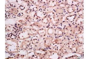 Formalin-fixed and paraffin embedded human kidney labeled with Anti-GRB10/14 Polyclonal Antibody, Unconjugated  at 1:300 followed by conjugation to the secondary antibody and DAB staining. (GRB10/14 (AA 501-594) Antikörper)