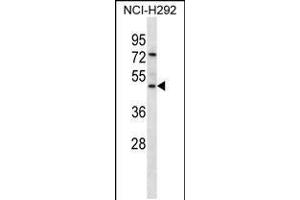 Western blot analysis in NCI-H292 cell line lysates (35ug/lane). (GP2 Antikörper  (N-Term))