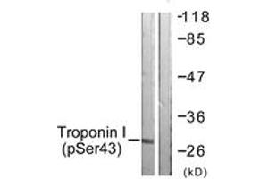 Western blot analysis of extracts from Jurkat cells, using TNNI3 (Phospho-Ser43) Antibody. (TNNI3 Antikörper  (pSer43))