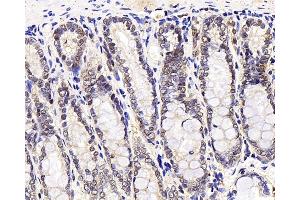 Immunohistochemistry analysis of paraffin-embedded rat stomach node using MGMT Polyclonal Antibody at dilution of 1:300. (MGMT Antikörper)