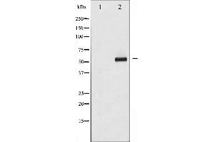 Western Blotting (WB) image for anti-Myc Proto-Oncogene protein (MYC) (pThr58) antibody (ABIN6256584)