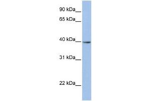 WB Suggested Anti-ZNF202 Antibody Titration:  0. (ZNF202 Antikörper  (N-Term))