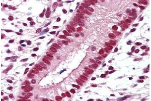 Anti-RXRB antibody IHC staining of human uterus.