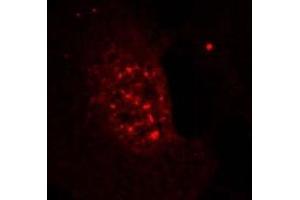 Image no. 3 for anti-V-Akt Murine Thymoma Viral Oncogene Homolog 1 (AKT1) (pThr308) antibody (ABIN196710) (AKT1 Antikörper  (pThr308))