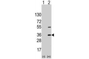 Western blot analysis of SSR1 (arrow) using SSR1 polyclonal antibody . (SSR1 Antikörper  (N-Term))
