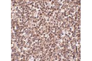 Immunohistochemistry of TREX1 in human spleen tissue with this product at 2.