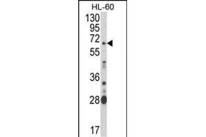 Western blot analysis of ARSB Antibody (Center) (ABIN652346 and ABIN2841582) in HL-60 cell line lysates (35 μg/lane). (Arylsulfatase B Antikörper  (AA 235-266))