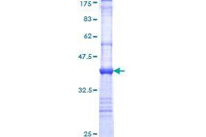 FBXL17 Protein (AA 194-303) (GST tag)